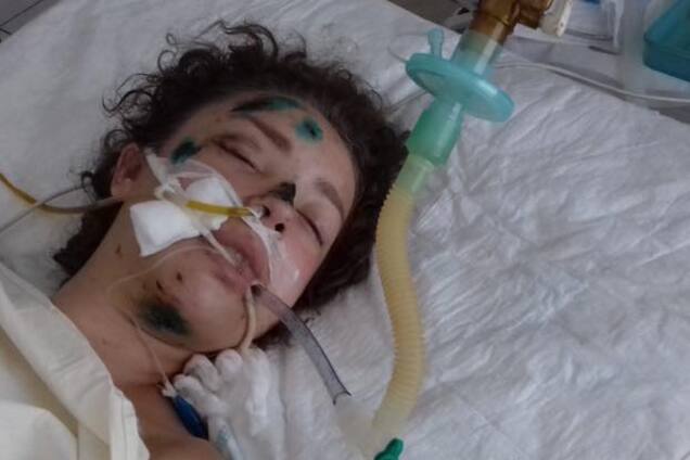 Без сознания после ДТП: украинцев попросили о помощи в опознании девушки