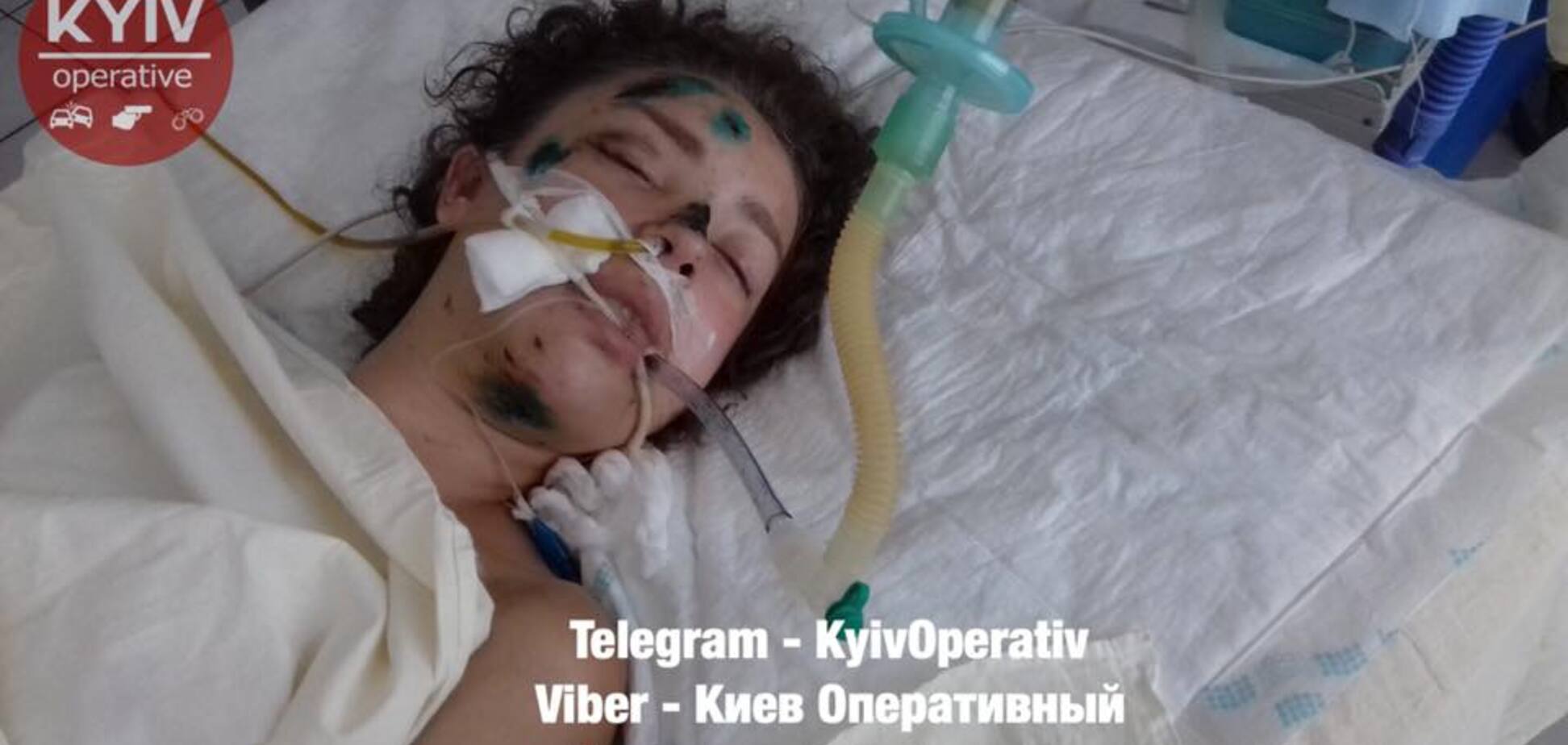 Без сознания после ДТП: украинцев попросили о помощи в опознании девушки