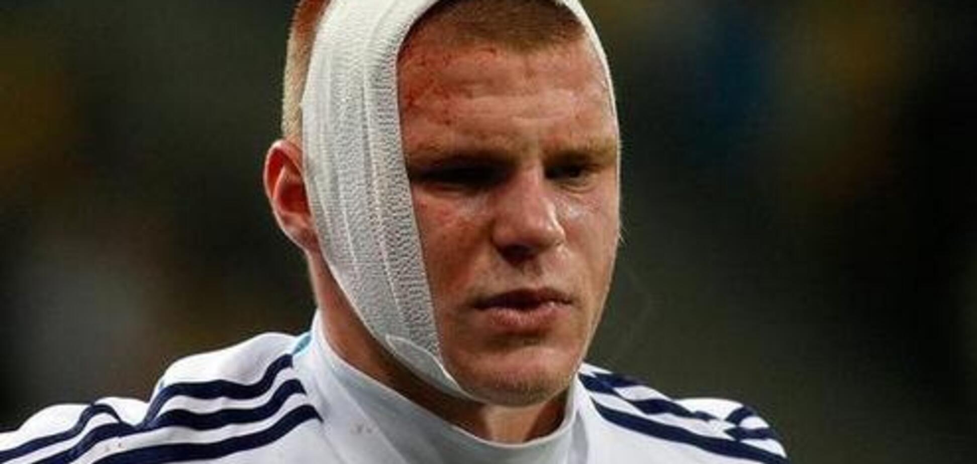 'Летали над нами': защитник 'Динамо' рассказал об опасности в матче со 'Славией'