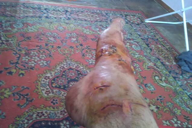 'Стрелять вместе с хозяином!' В Киеве бойцовская собака покалечила прохожего