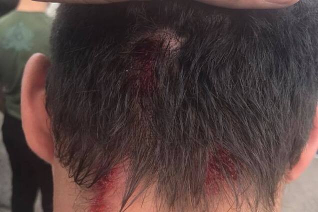 Под Харьковом подстрелили известного блогера: есть подробности и фото