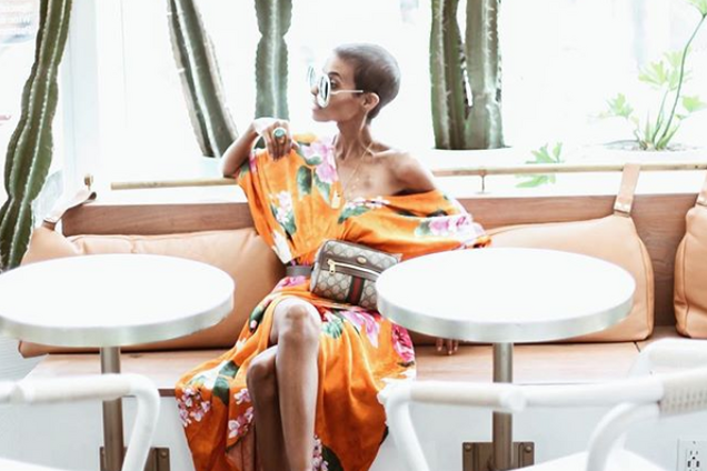 'Одним ангелом больше': известная блогерша скончалась от страшной болезни