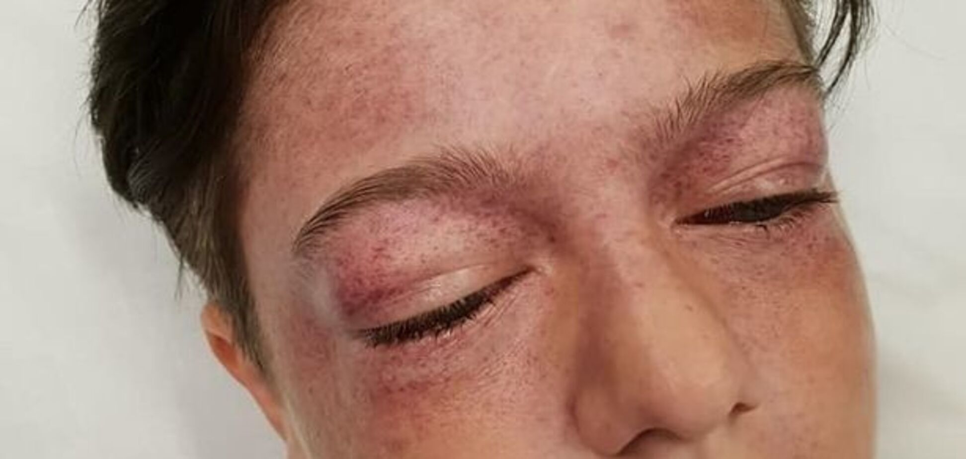 Глаза вылезли из орбит: школьник стал жертвой жуткого трюка из Youtube