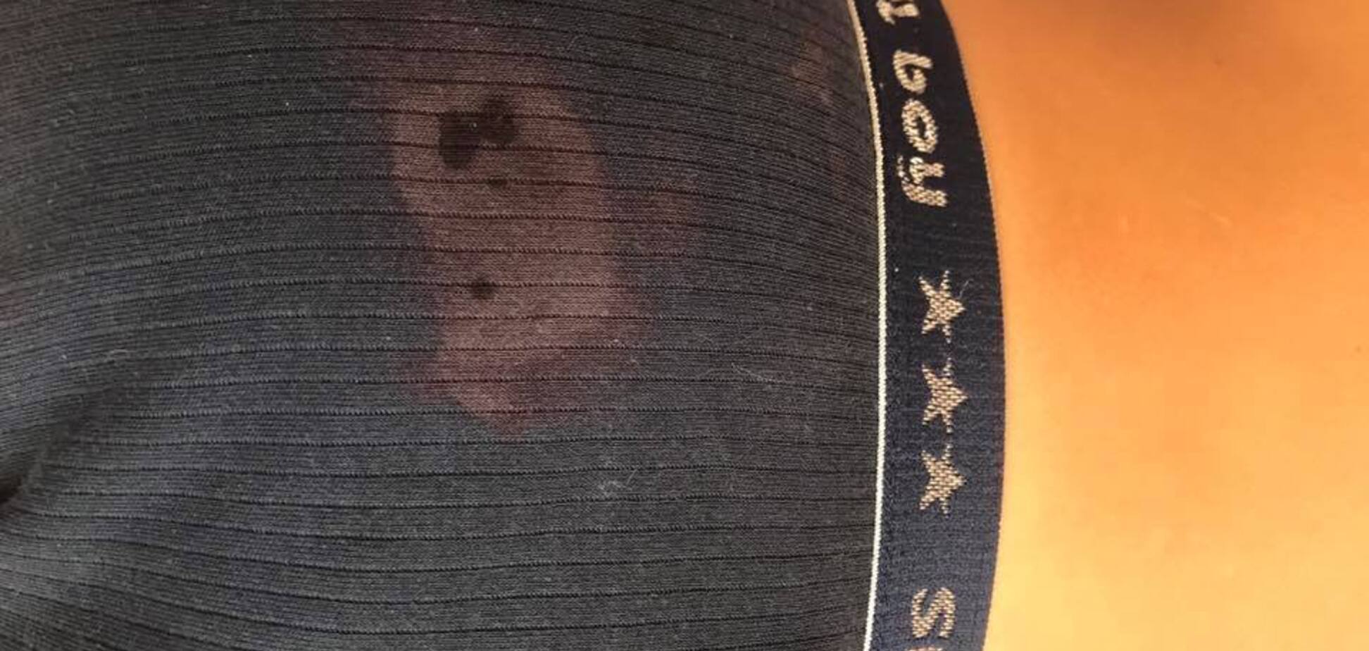 ''Труси вигоріли!'' У Києві стався жахливий інцидент зі ''швидкою'' і дитиною