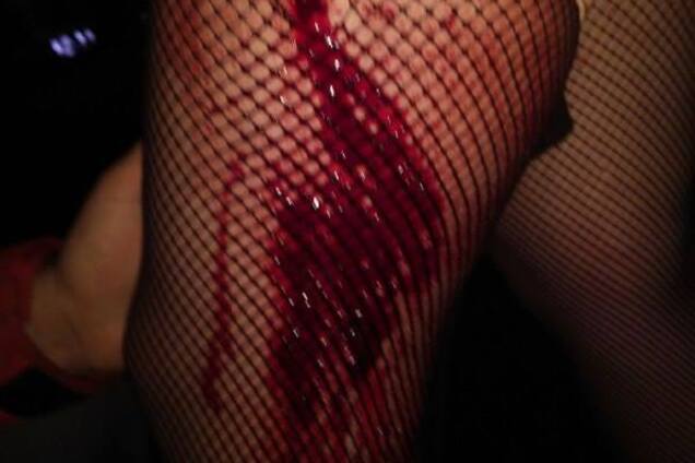 ''Потому что мы против фашизма'': банда ультраправых зверски избила львовян