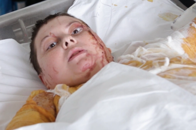 ''Чому ми повинні терпіти?'' Облита кислотою Гандзюк звернулася до українців із сильною промовою