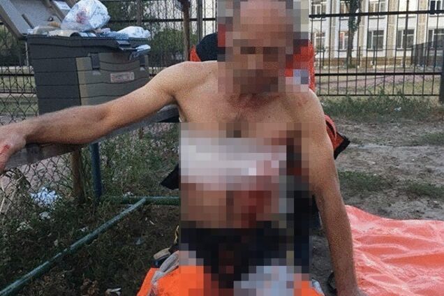 У Києві поблизу школи знайшли чоловіка в крові: фото з місця НП. 18+