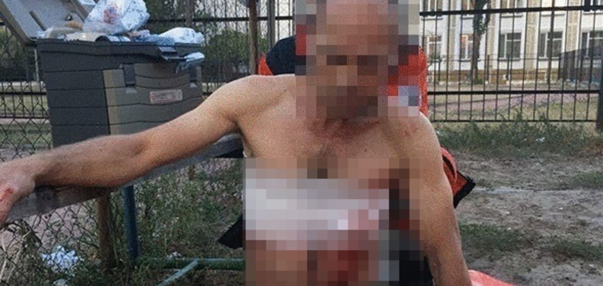 У Києві поблизу школи знайшли чоловіка в крові: фото з місця НП. 18+