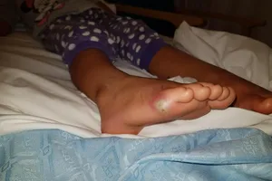 У Британії дитина ледь не померла після примірки взуття