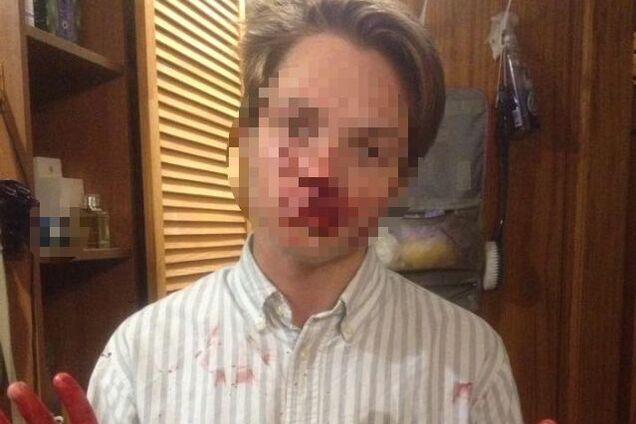 ''Люди - пацюки!'' У Кам'янському на очах у натовпу жорстоко побили підлітка