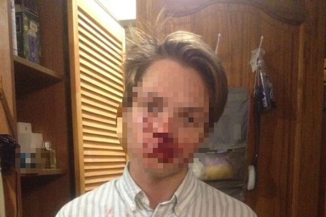 ''Багато жертв'': у Кам'янському банда підлітків залякала навіть дорослих