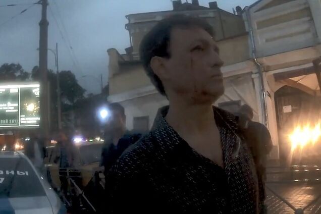 ''Я звезда, а ты — никто!'' В Одессе пьяным на дороге поймали ''друга Трампа''