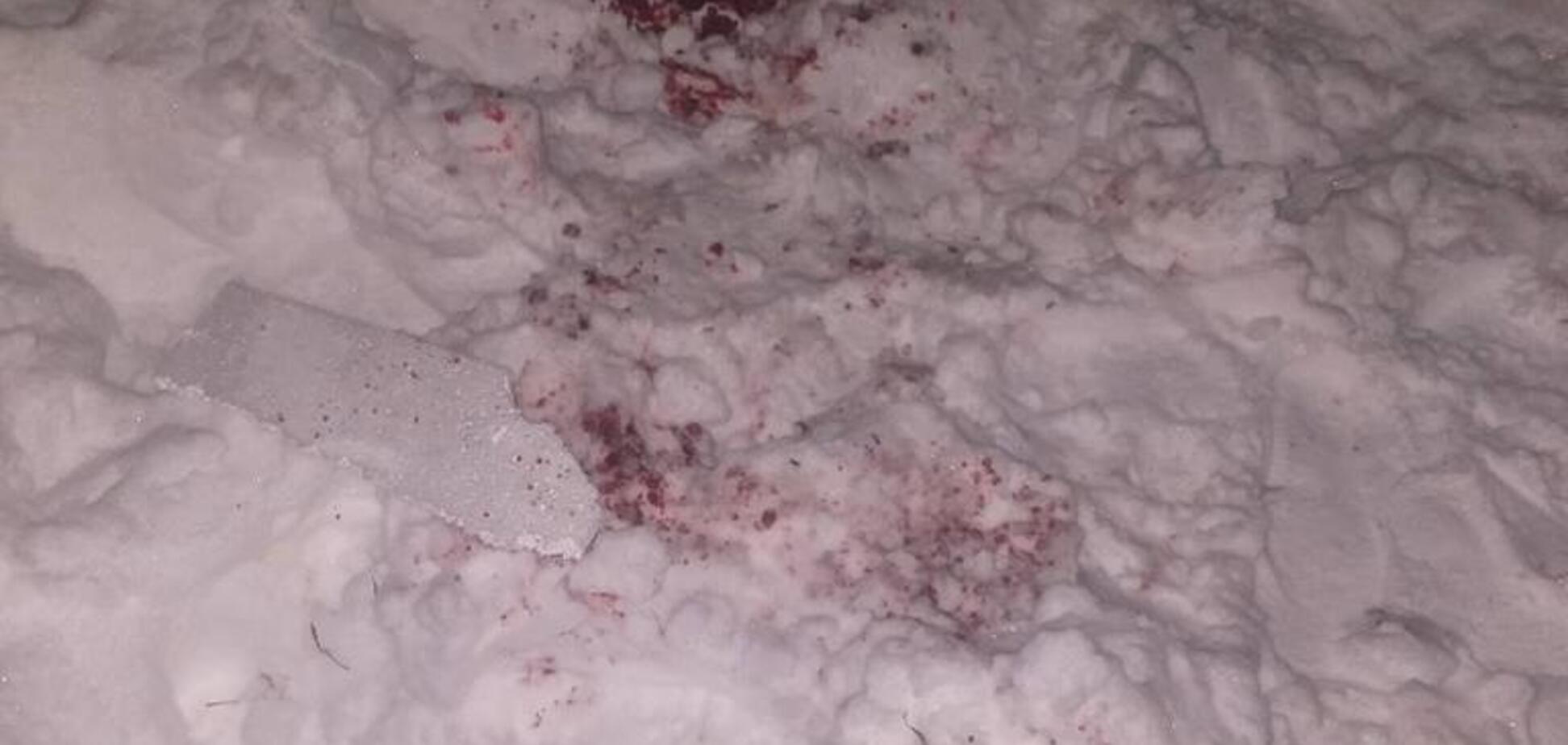 Раны и ампутация: в Харькове мужчина испытал ужасы новогоднего фейерверка