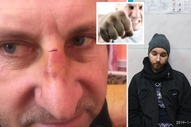 ''Церковь вне закона'': на Одесщине сын священника зверски избил афганца