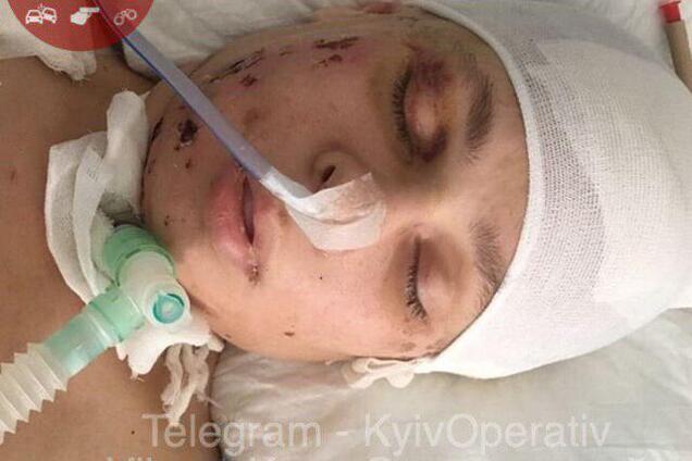 Рухнула с высоты: в Киеве нашли искалеченную женщину с татуировкой