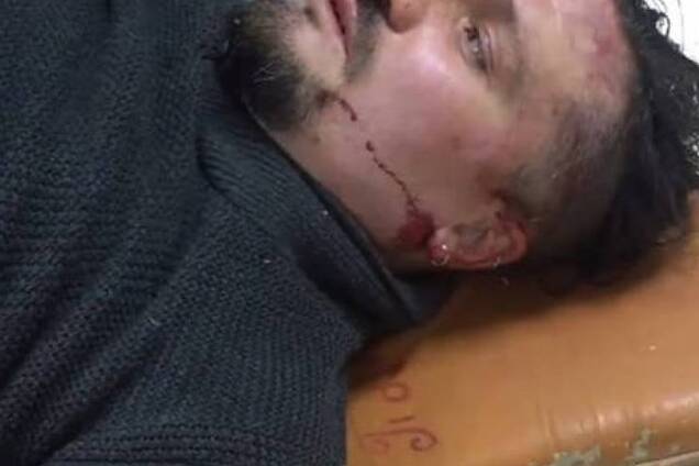 В Запорожье жестоко избили активиста, выступавшего против продажи наркотиков