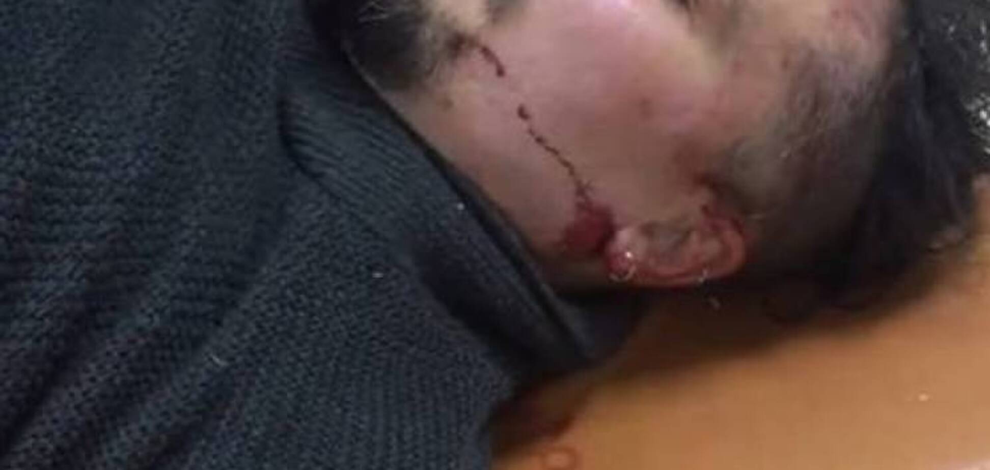 В Запорожье жестоко избили активиста, выступавшего против продажи наркотиков