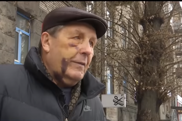 Лупцювали ногами по голові: у Києві жорстоко побили авіаконструктора ''Мрії''