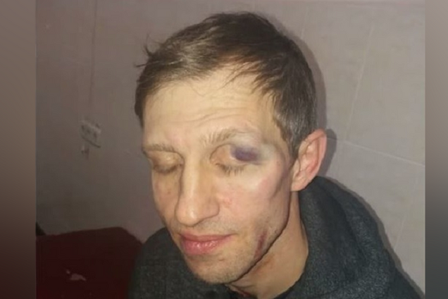 В Киеве отец школьника жестоко избил учителя: появились новые подробности
