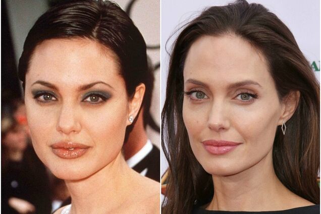 Топ-3 трендов в пластической хирургии