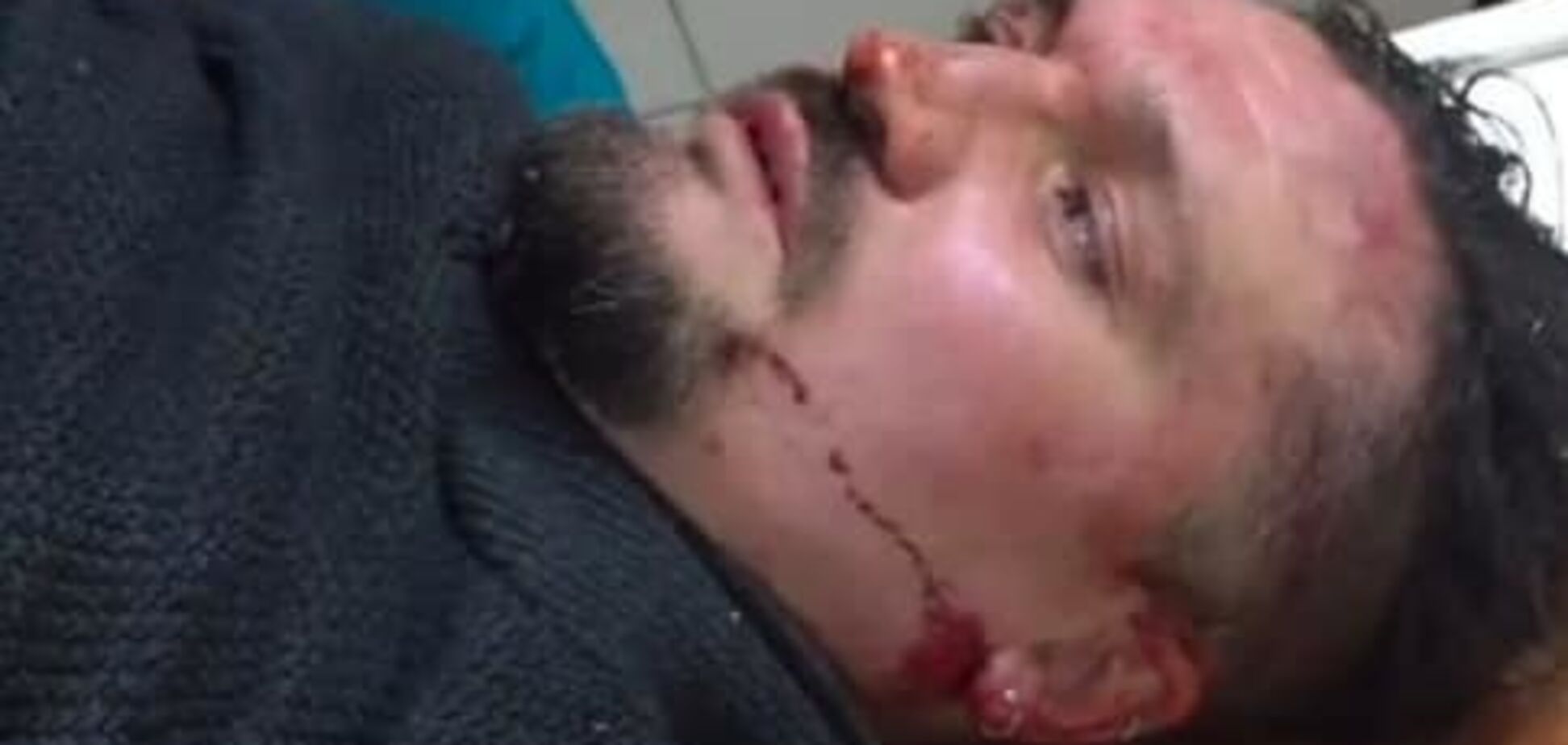 ''Шакалята безхребетні!'' З'явилося відео звірячого побиття активіста у Запоріжжі. 18+