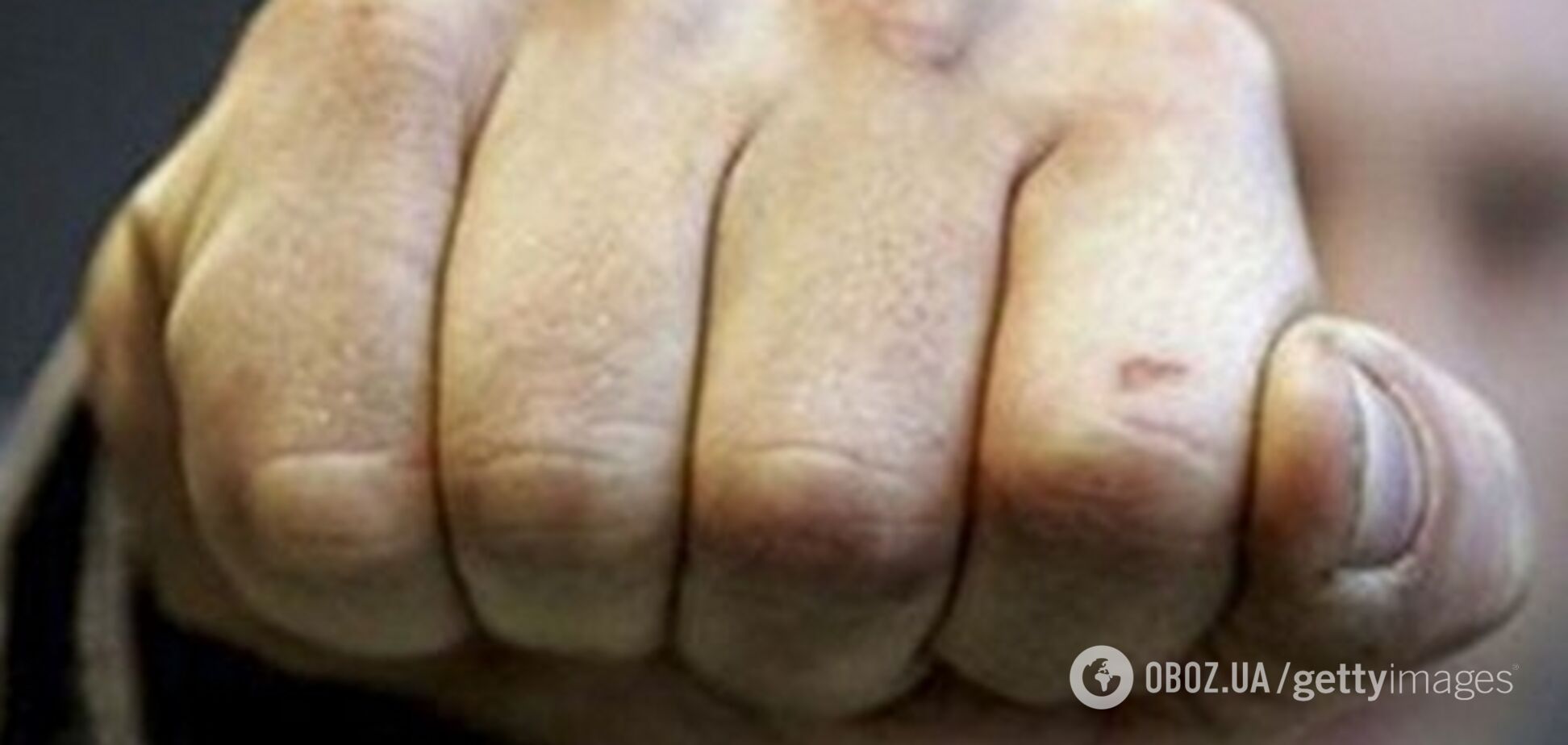 Жестокое избиение учителя в Киеве: директор лицея выступил с заявлением