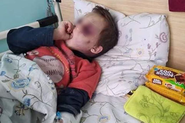 Под Винницей зверски избили 6-летнего ребенка: новые подробности и жуткие фото. 18+