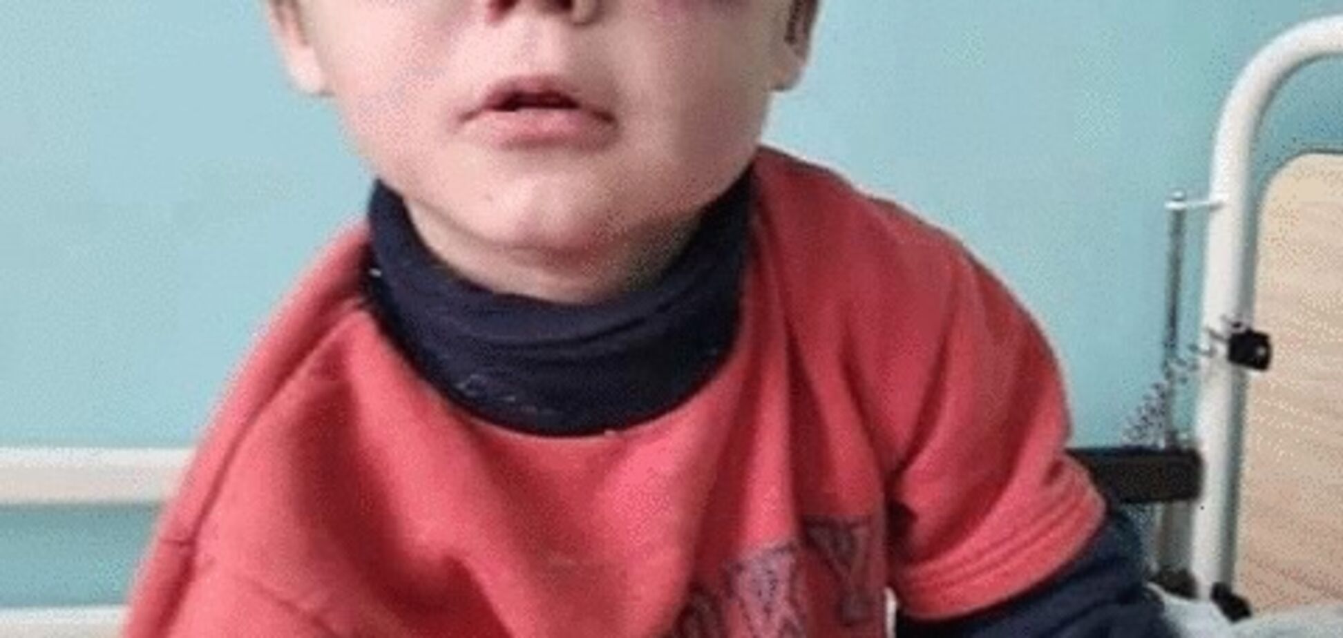 За синцями не видно очей: на Вінниччині знайшли жорстоко побиту маленьку дитину. Фото 18+