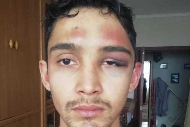 'Душили, лили кипяток и резали': в России пьяные силовики пытали невиновного парня. Фото и видео 18+