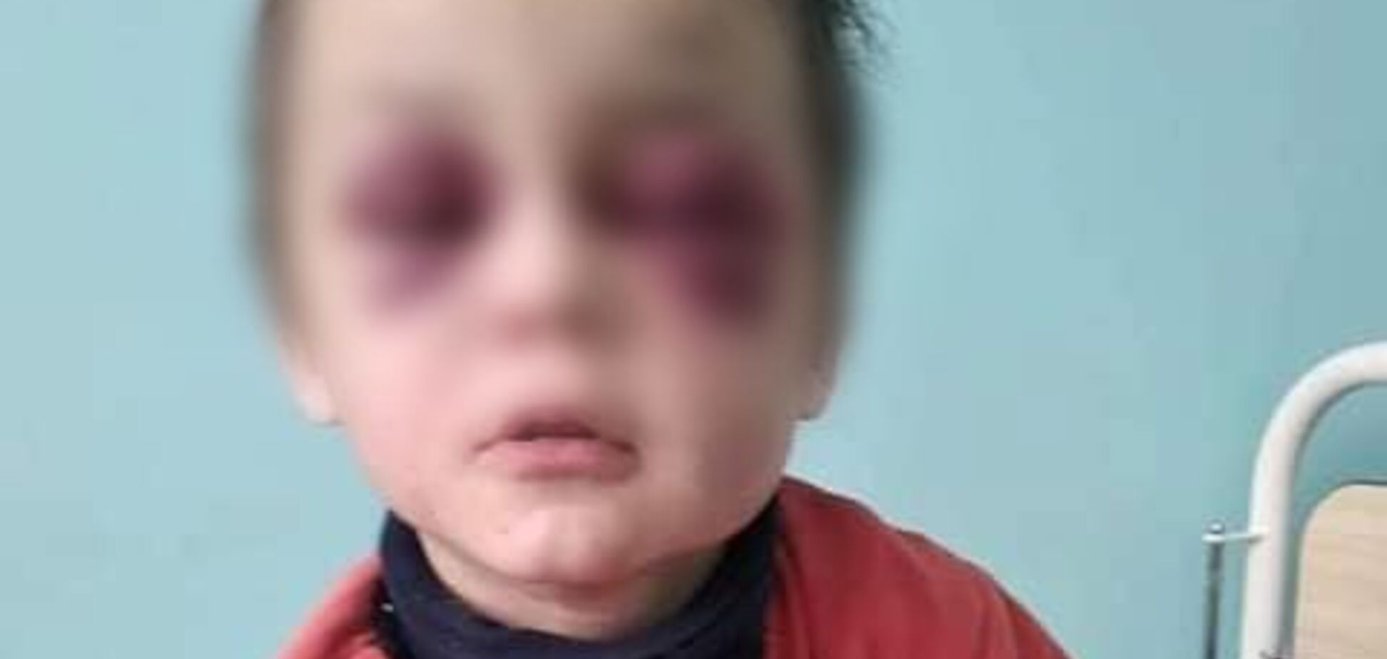 Под Винницей зверски избили 6-летнего малыша: горе-мачеха загадочно исчезла