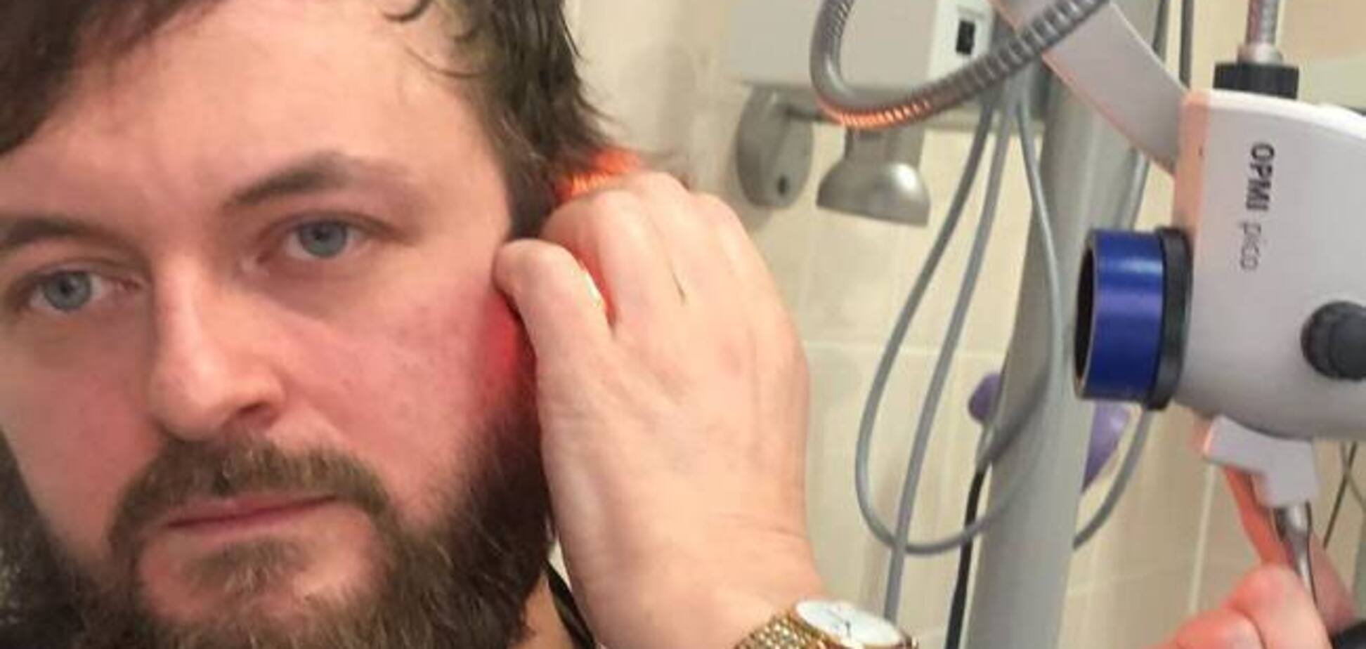 Мог потерять слух: DZIDZIO запел впервые после избиения