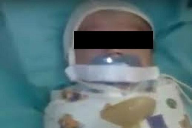 ''Рот заклеїли пластиром'': у Росії спалахнув скандал через інцидент з новонародженим