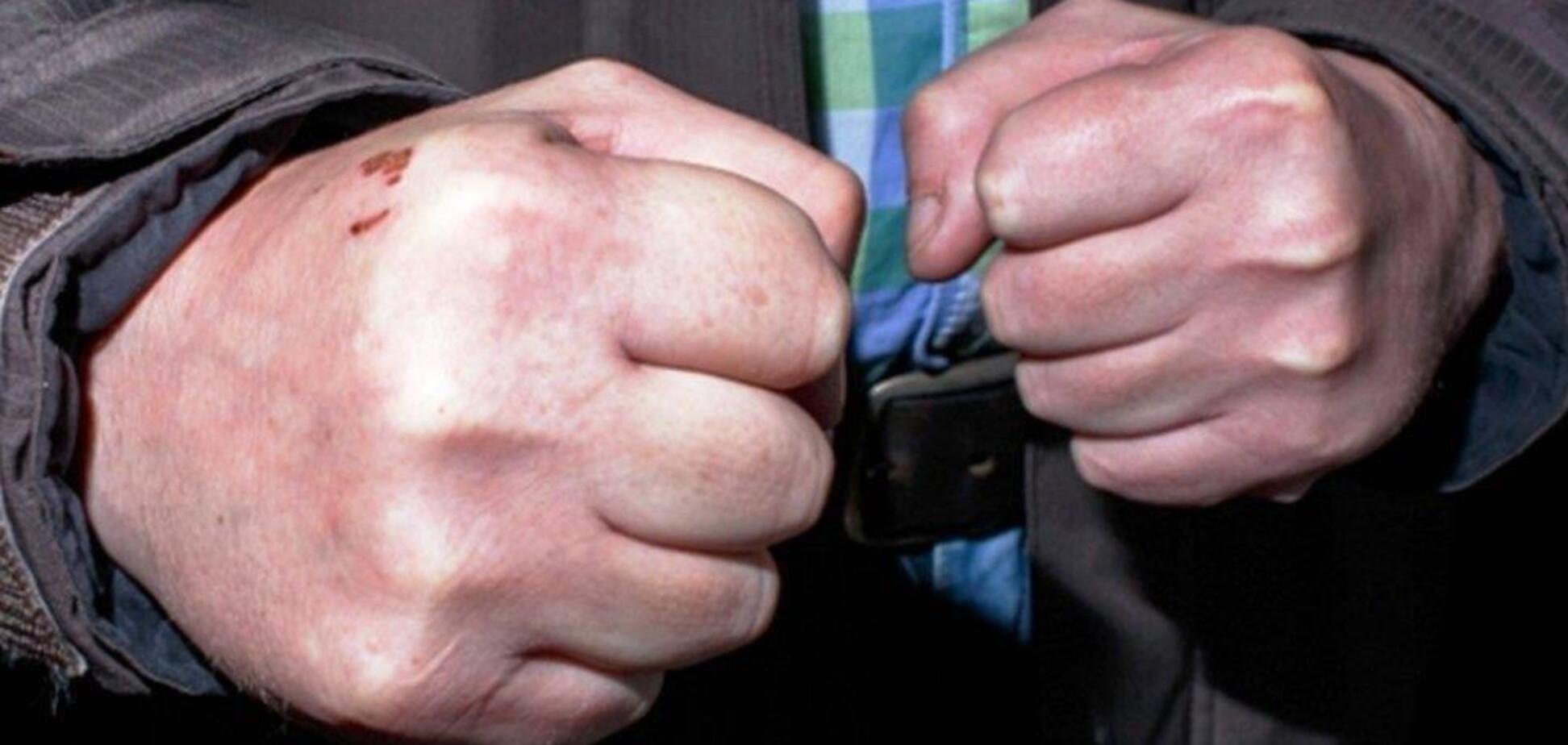 'Страшно дивитися': у Києві чоловіка забили до смерті через ревнощі