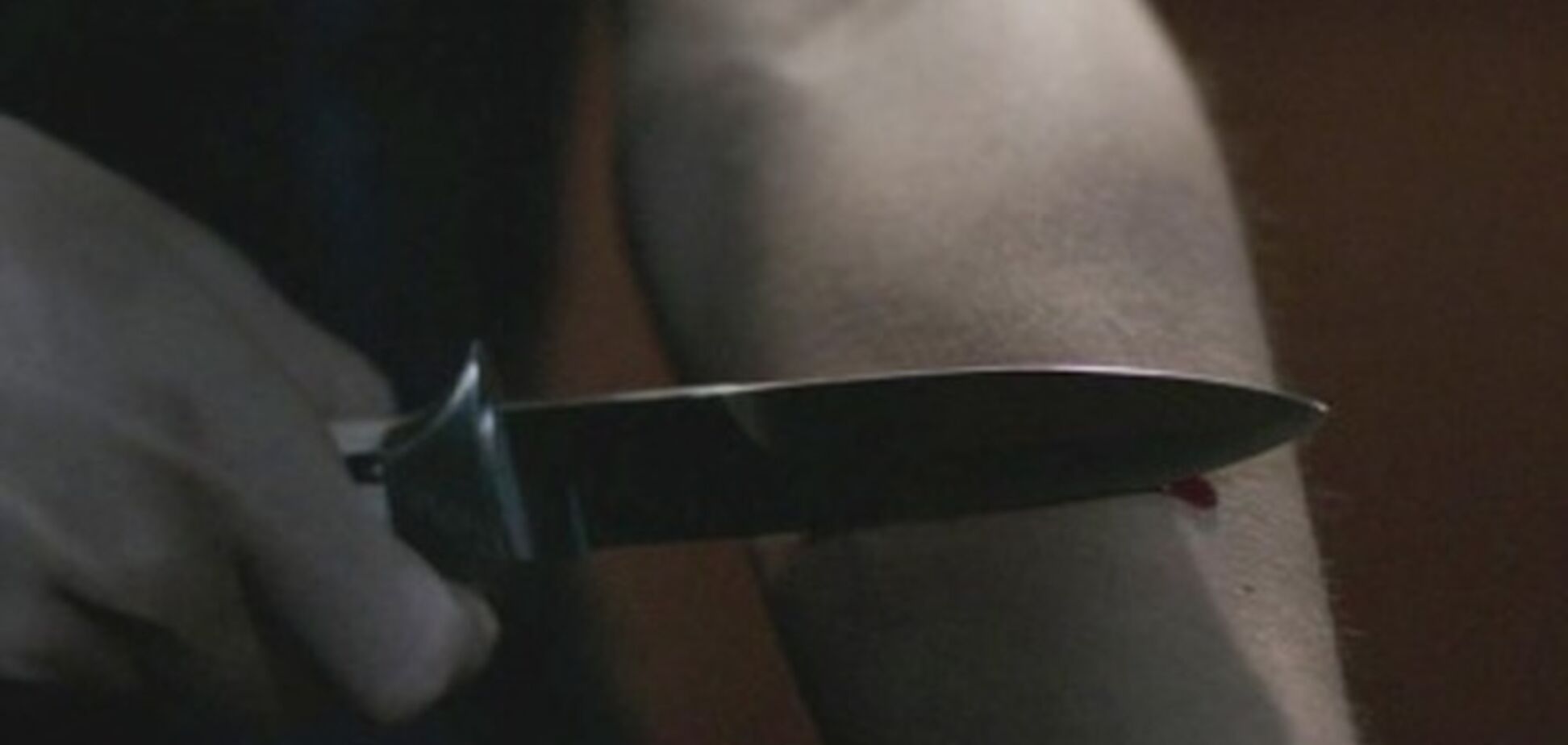 Резал себя и бросался на спасателей: в Днепре мужчина пытался покончить с собой. Фото 18+