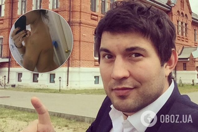 'Нанес 26 ударов тупым предметом': сын скандального Алибасова жестко избил любовницу