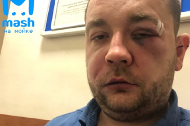 Головой об капот: в России таксист жестоко расправился с пассажиром