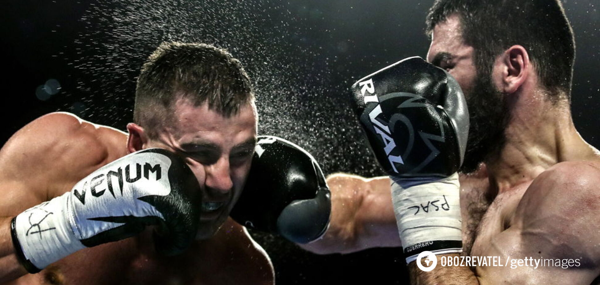 'Боль в затылке': стало известно о состоянии госпитализированного Гвоздика