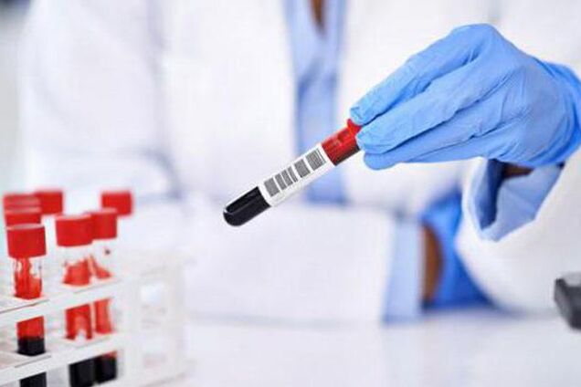 В Україні зафіксували новий спалах гепатиту: постраждали школярі