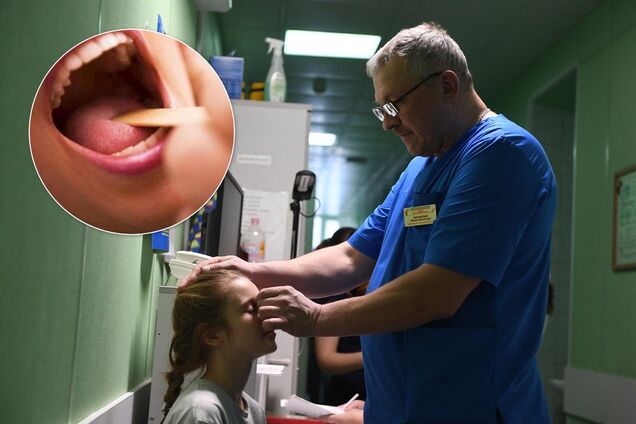 В Киеве второй случай дифтерии, прививки не помогают: новые подробности страшной вспышки