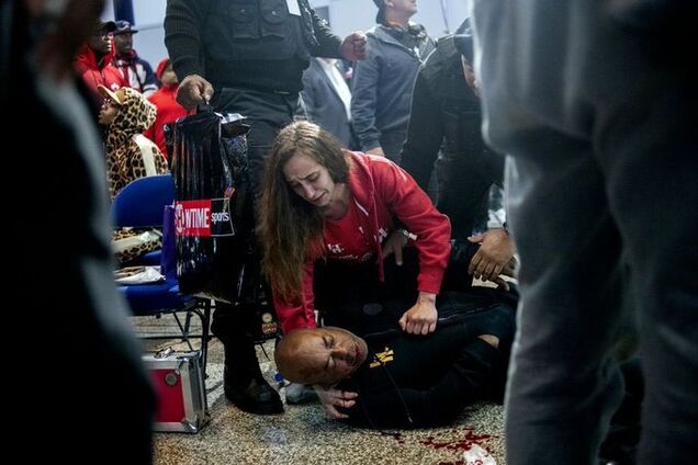 Экс-тренера Усика и Кличко жестко избили, сломав лицо - опубликовано видео и фото