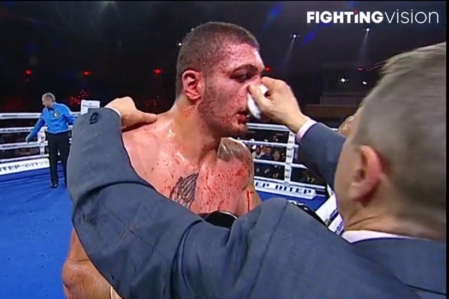Знаменитий український боксер переміг кривавим нокаутом - опубліковано відео