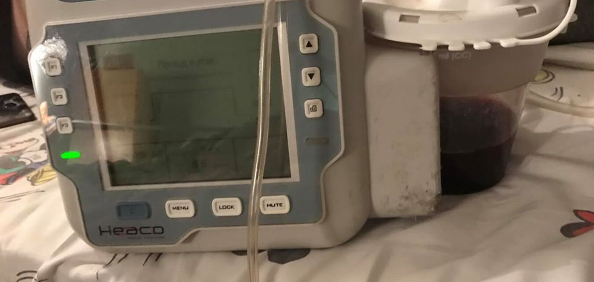 Сбор денег для аппарата в реанимацию госпиталя: кто поможет, как не мы