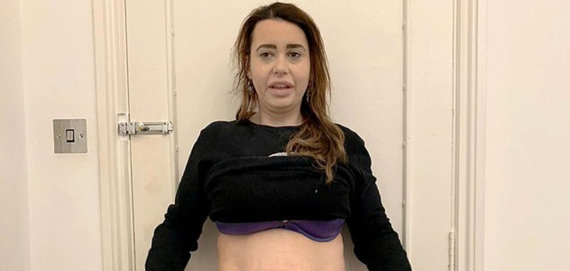 Схудла і пошкодувала: британка, яка скинула 70 кг, поділилася жахливою історією
