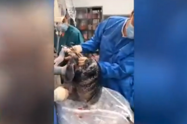 В сети показали легкие мертвого курильщика: шокирующее видео