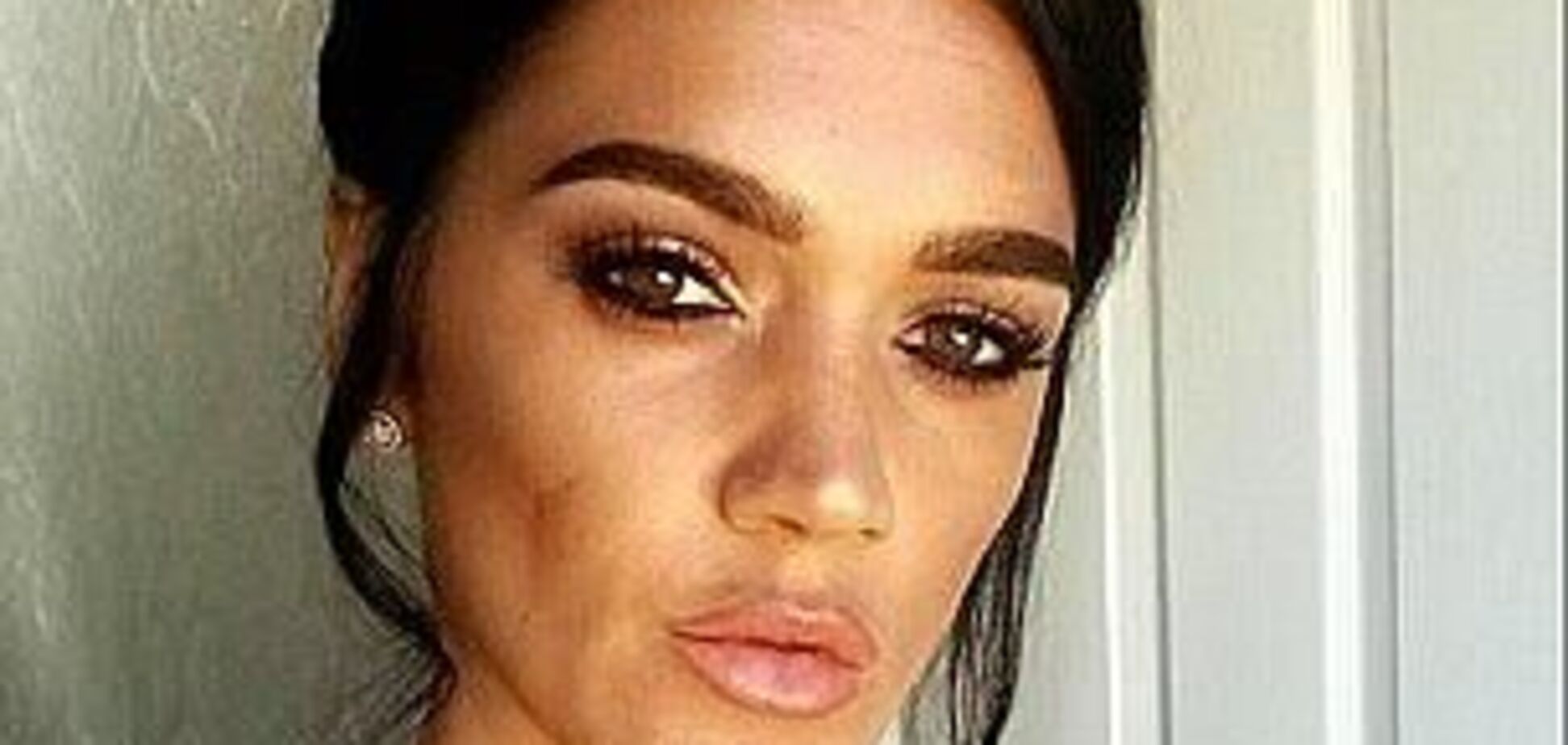 Мать троих детей умерла жуткой смертью, увеличив ягодицы