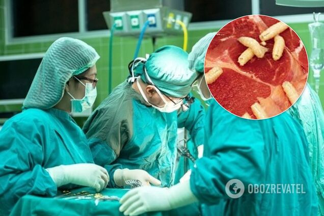 Поласував свининою: у мозку і легенях китайця виявили понад 700 паразитів