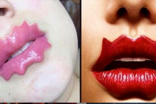 Губы-осьминоги: новый косметологический тренд вызвал горячие дискуссии
