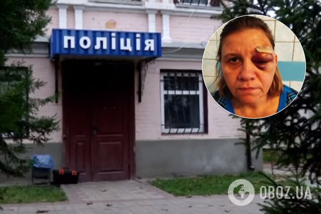 'Отрублю руки, вырву языки!' На Черкасщине экс-милиционер избил семью. Фото и видео