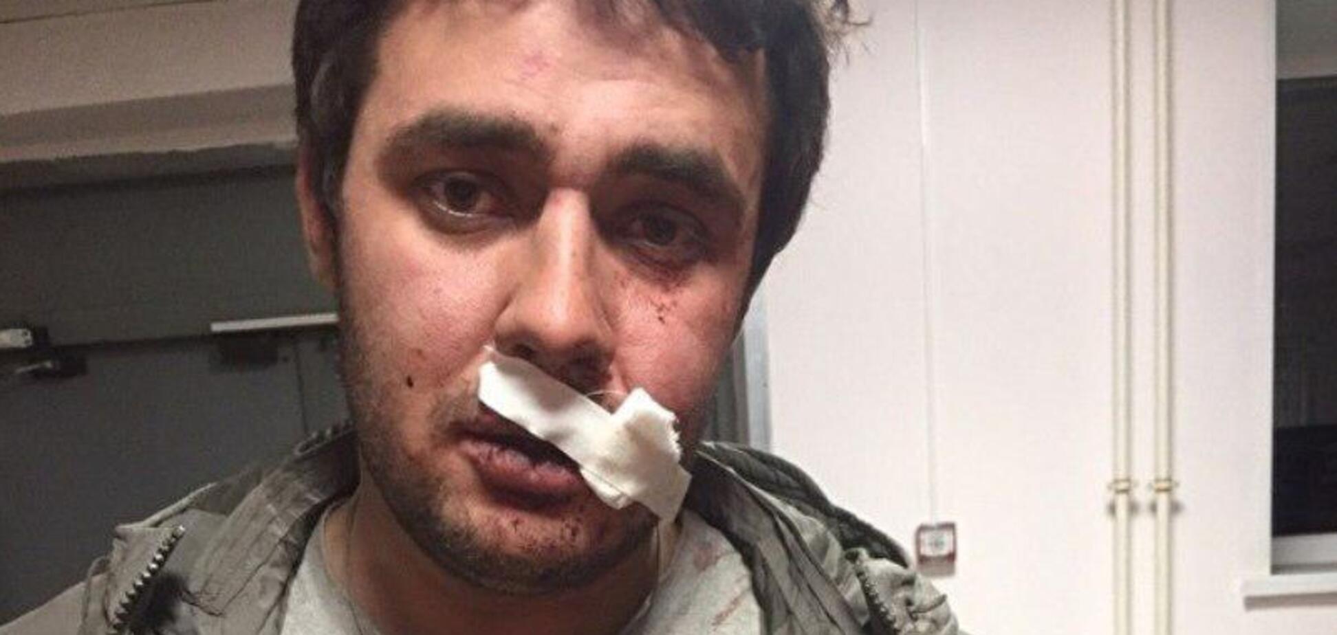 Депутату Путина порвали щеку за замечание: подробности