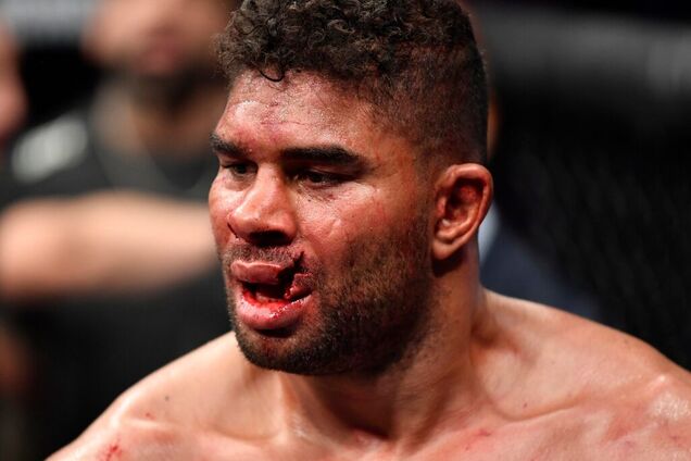 Боєць UFC отримав жахливу травму на останній секунді бою: фото і відео 18+